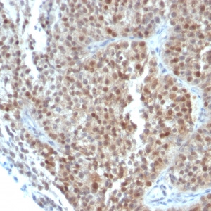 p21WAF1 (Tumor Suppressor Protein); Clone CIP1/823 & DCS-60.2 (Concentrate)